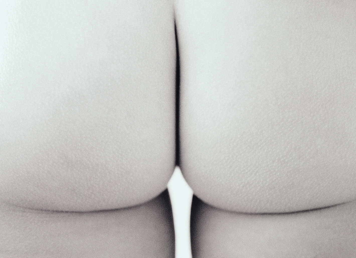 Po-Aufbau mit der Tower-Technik und stark vernetzter Hyalurons&auml;ure Macrolane&trade;.