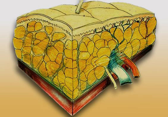 In the subcutaneous tissue, the fat cells absorb the anesthesia fluid of the tumescent local anesthesia, swell and become easier to aspirate. The connective tissue that is tightened due to the increased volume is preserved.