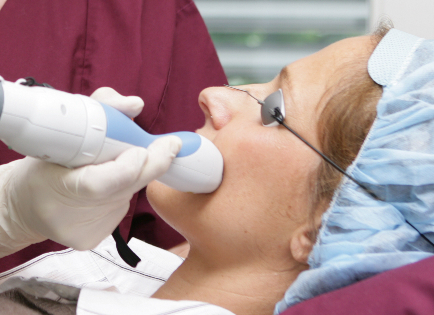 Laserbehandlung in der Rosenpark Klinik: Bei der Therapie zur Hautverjüngung fährt der Dermatologe systematisch mit einem Handstück über die Haut. Dermatologe fährt während der Laserbehandlung systematisch mit einem Handstück über die Haut