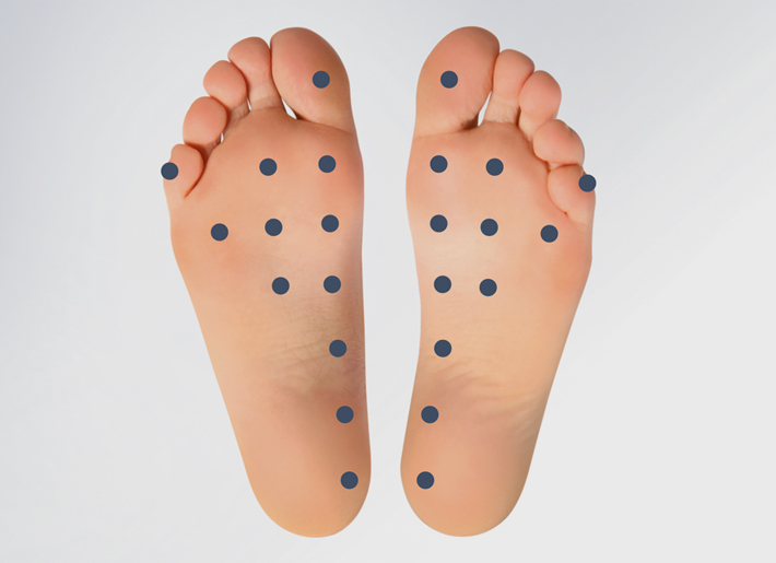 Bei Hyperhidrose werden in der Rosenpark Klinik übermäßig arbeitende Schweißdrüsen an den Füßen gezielt durch Botox® blockiert. Bei Hyperhidrose werden in der Rosenpark Klinik übermäßig arbeitende Schweißdrüsen an den Füßen gezielt durch Botox® blockiert.