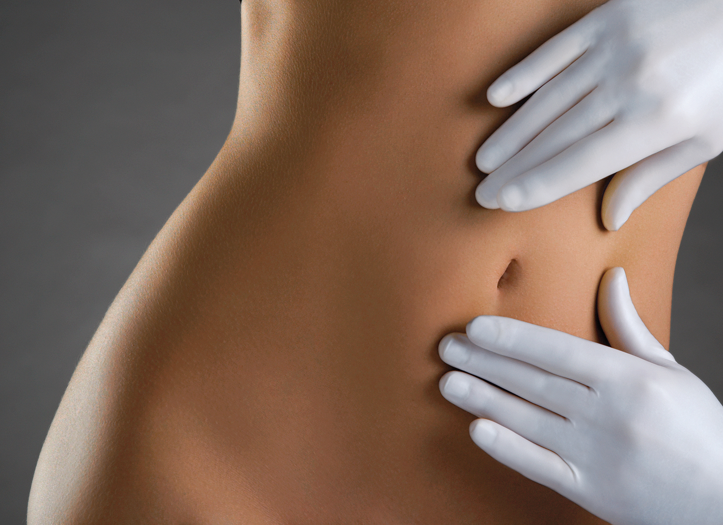 Eine Bauchstraffung in der Rosenpark Klinik beseitigt auch Schwangerschaftsstreifen und Blinddarmnarben. Neue Techniken machen sehr &auml;sthetische Ergebnisse m&ouml;glich und verstecken OP-Narben unter der Bikini- oder Badehose.