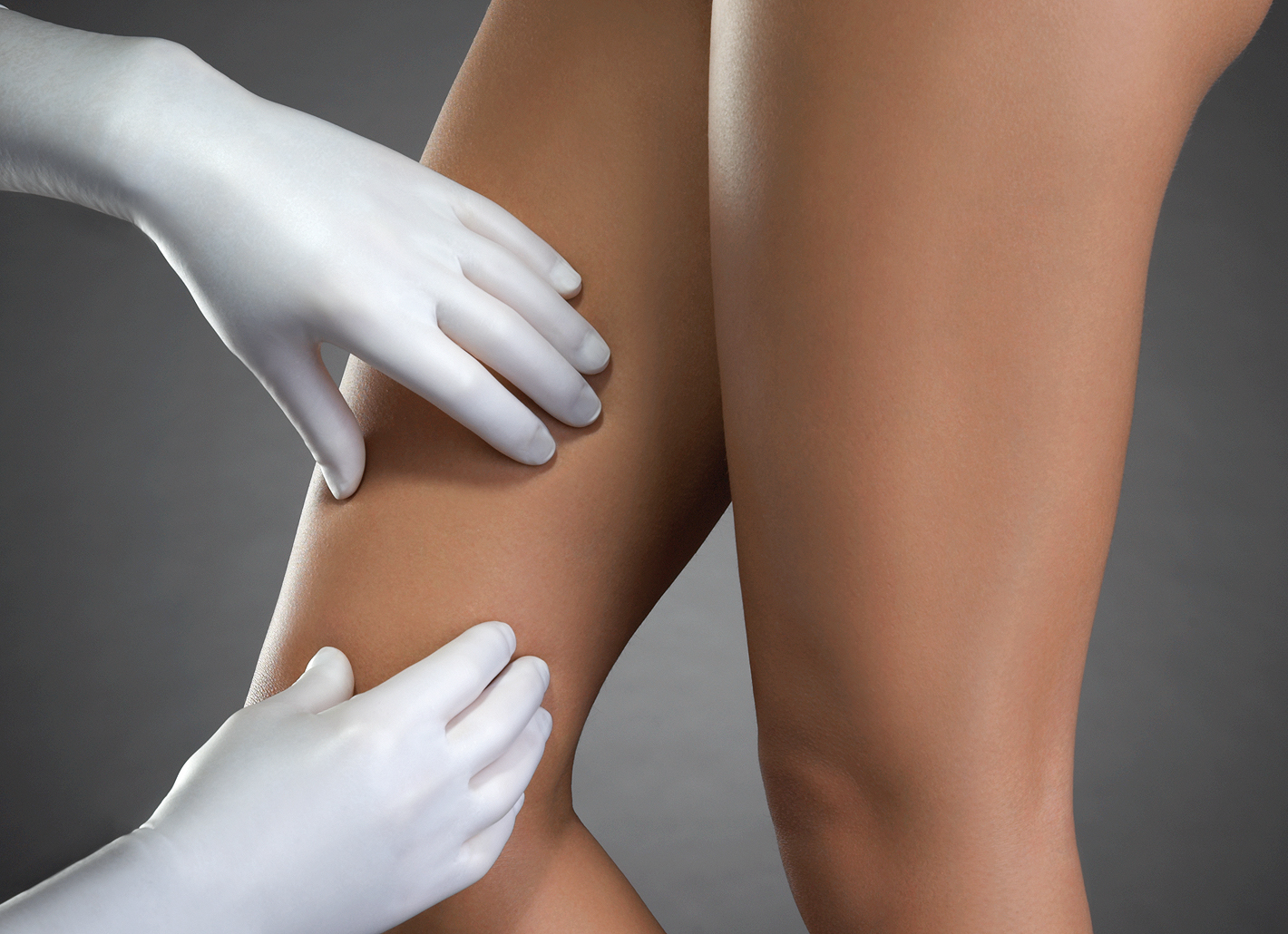 Die Fach&auml;rzte der Rosenpark Klinik gehen den Ursachen von Besenreisern und Krampfadern mit viel Fachwissen auf den Grund und empfehlen sinnvolle Behandlungsmethoden.