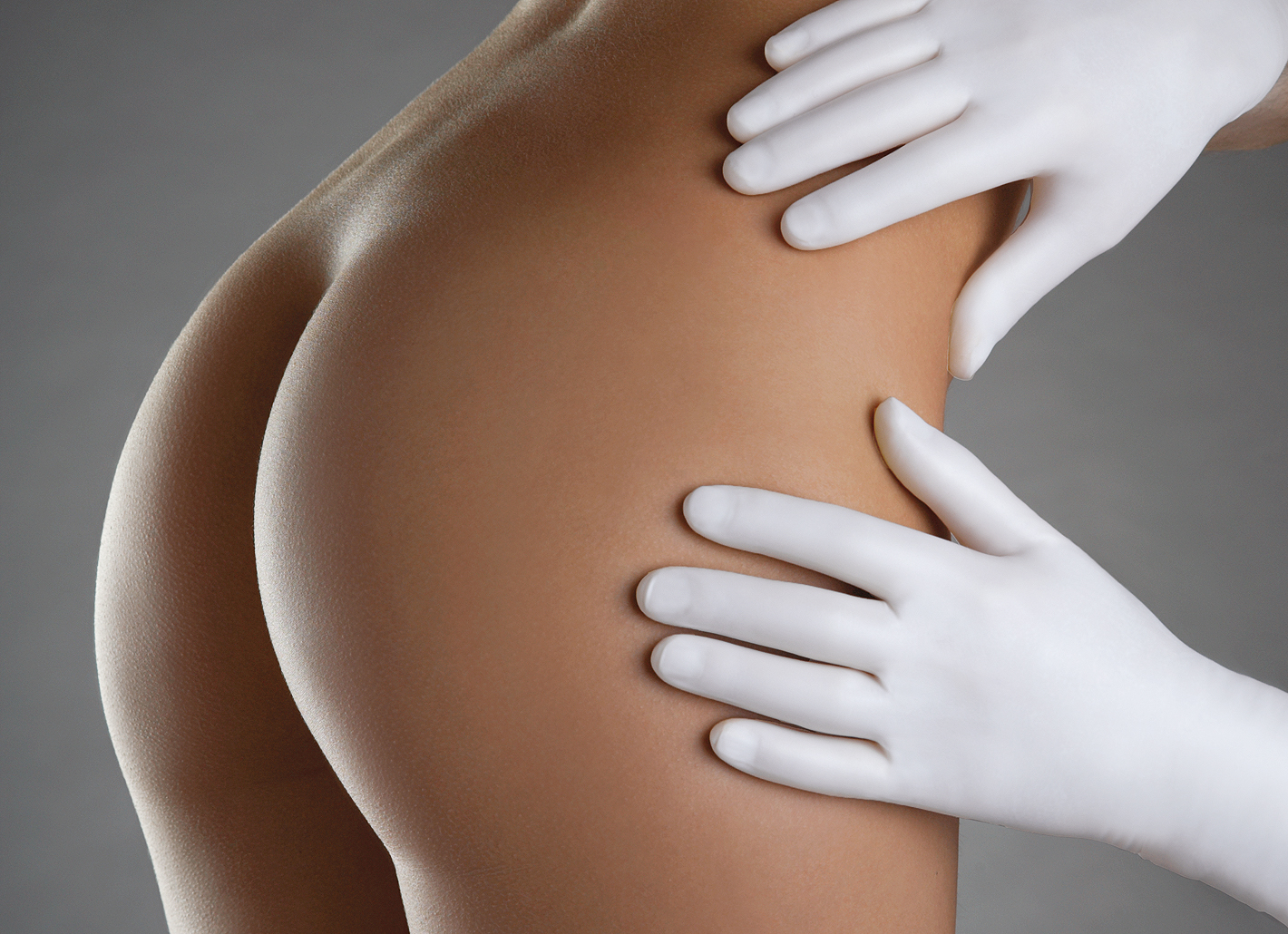 With a buttock lift, the surgeon tightens excess skin fat and places the incision in the gluteal crease.