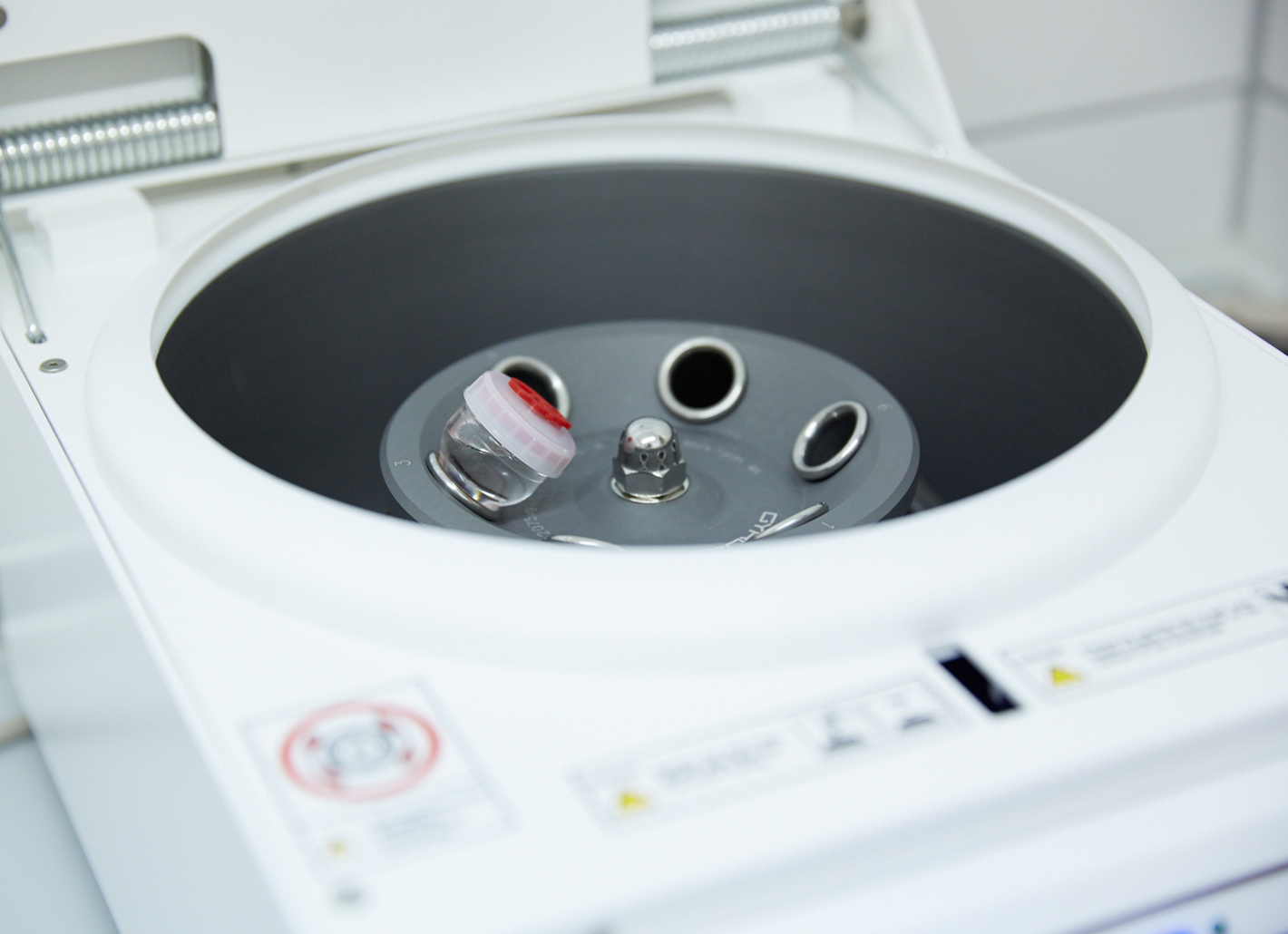 Zentrifuge mit Blutprobe