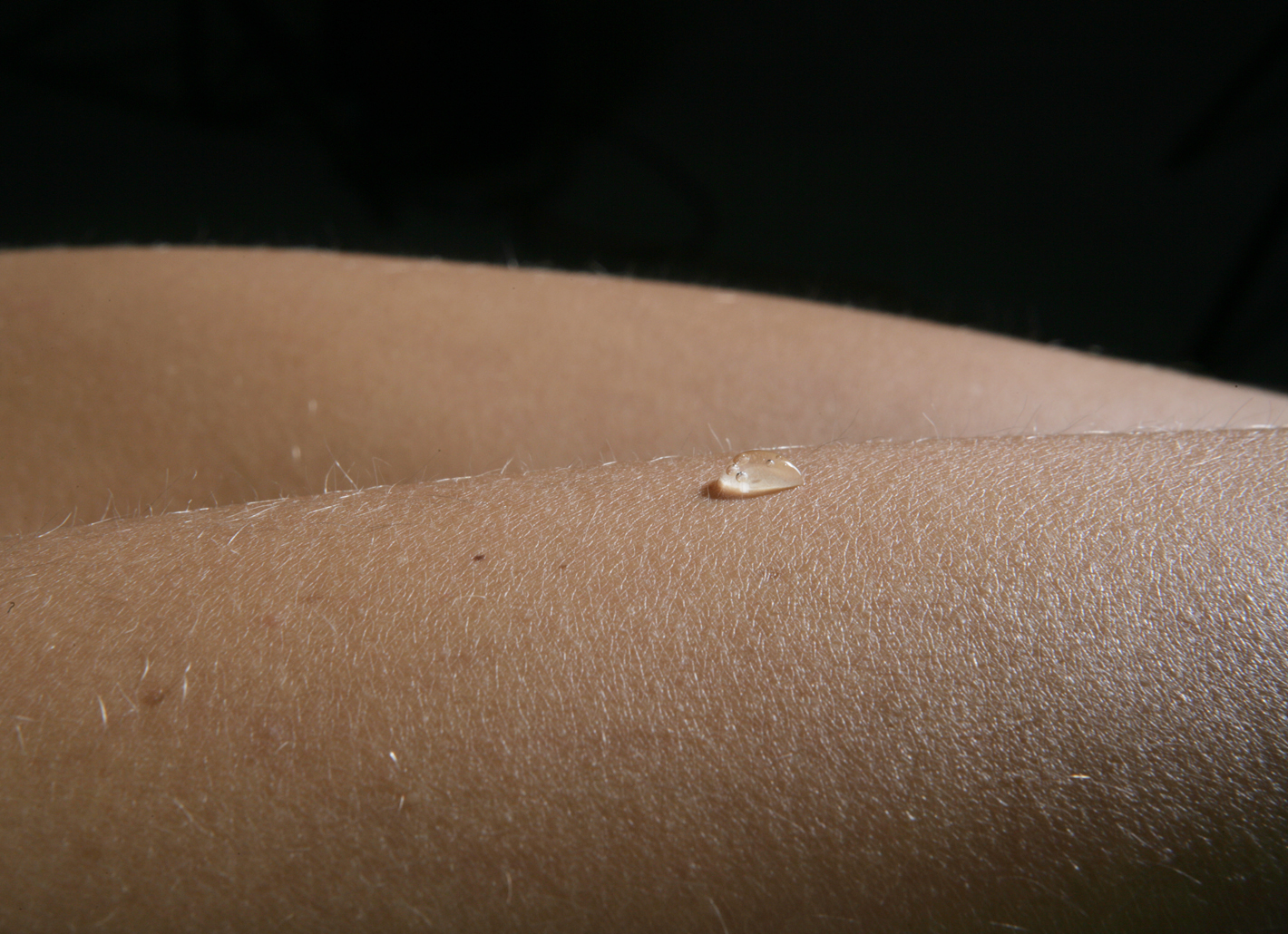 Gesunde Haut hat einen intakten Schutzmantel.