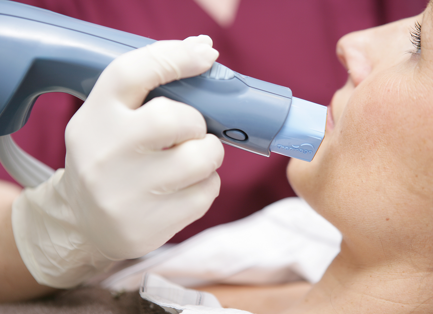 Thermage-Handst&uuml;ck f&auml;hrt &uuml;ber Kinnpartie