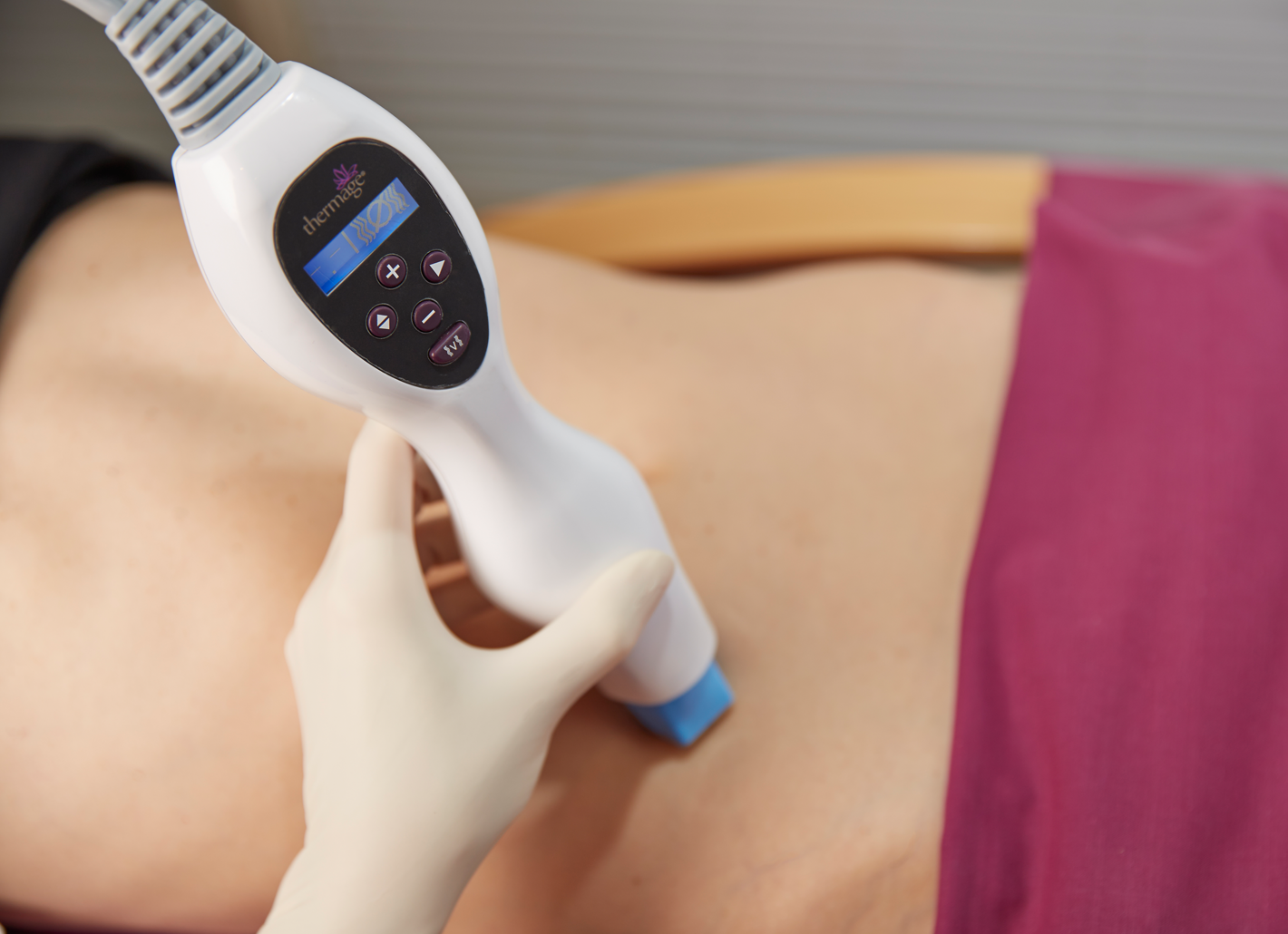 At Rosenpark Clinic the radiofrequency waves of Thermage® are applied with a handpiece for body skin rejuvenation.