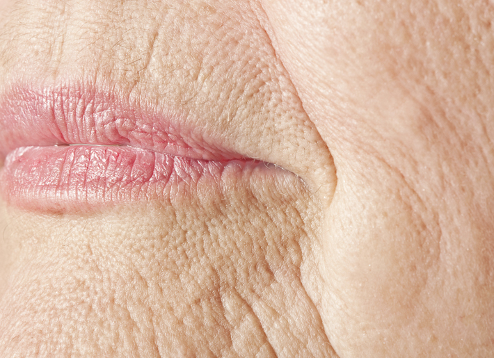 Faltige Haut rund um der Mundpartie 