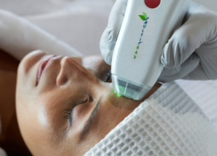 Behandlung eines Gesichts mit dem neuen MultiFrax Laser